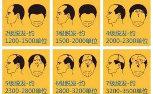 植发.jpg