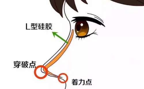 鼻子3.jpg