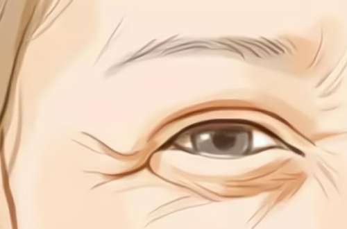 去除鱼尾纹3.jpg