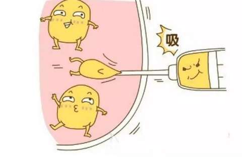 超声吸脂.jpg