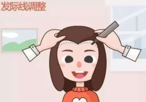 植发3.jpg