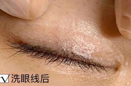 洗眼线2.jpg