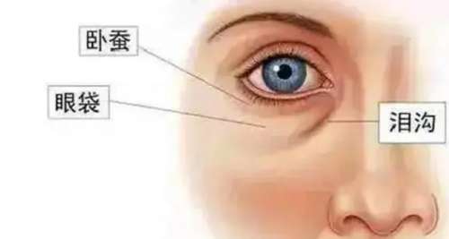 泪沟.jpg