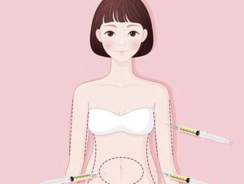 腹部吸脂.jpg 腹部吸脂.jpg