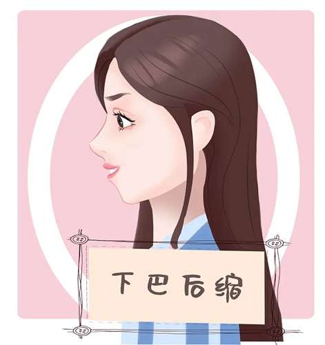 19ad1716644fe1f7249889421b87aa4c4e3b192e84c76-hi97RJ_fw658.webp.jpg