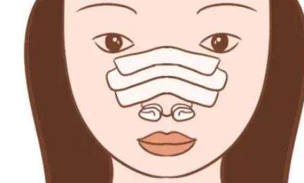 隆鼻手术动漫图04.jpg 隆鼻手术动漫图04.jpg