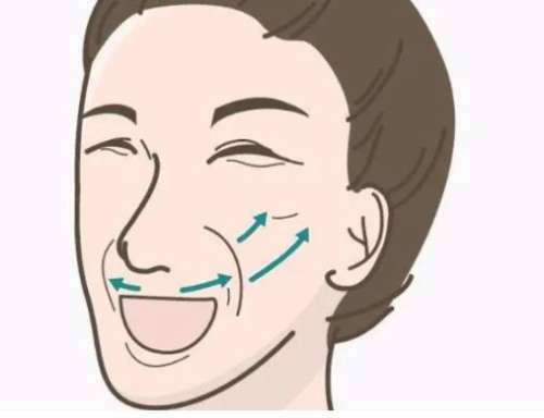 法令纹04.jpg 法令纹04.jpg