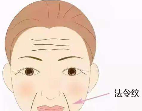 法令纹02.jpg 法令纹02.jpg