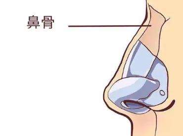 隆鼻dm03.jpg 隆鼻dm03.jpg