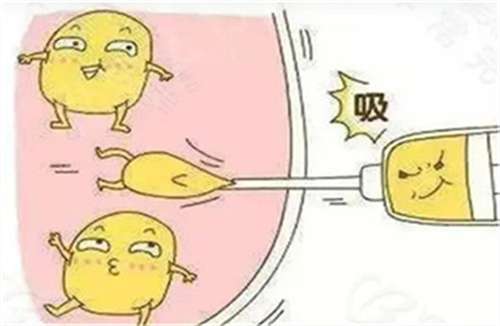 吸脂2.jpg