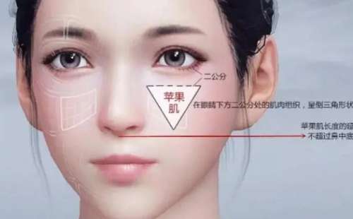 苹果肌复位.jpg