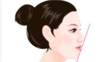 隆鼻123.jpg 隆鼻123.jpg