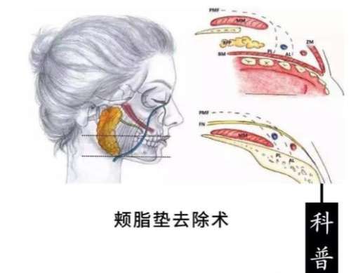 QQ截图20231110111516.jpg