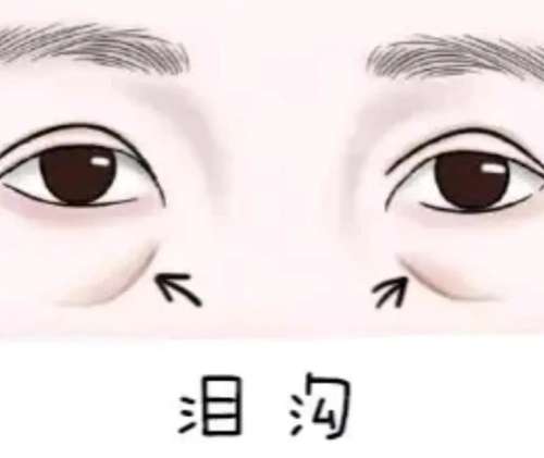 填充泪沟卡通2.jpg