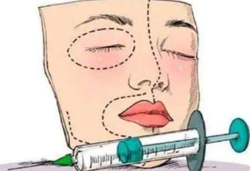 注射美容 注射美容