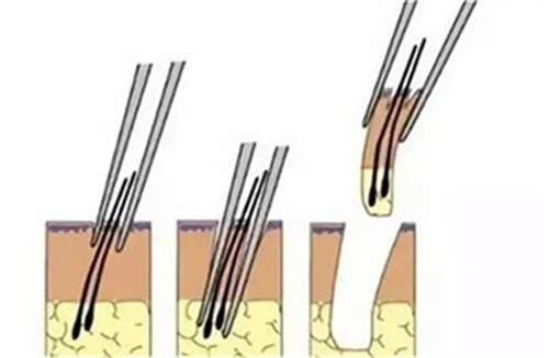 毛发7.jpg