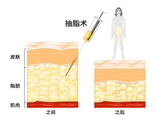 QQ截图20231227154339.jpg