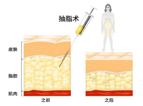 QQ截图20240108115642.jpg