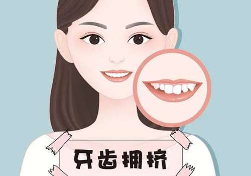 牙齿矫正6.jpg