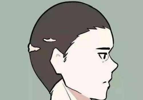 毛发4.jpg