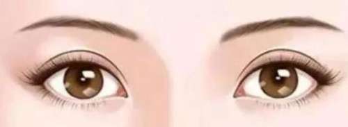 双眼皮 双眼皮
