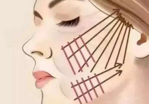 拉皮2.jpg
