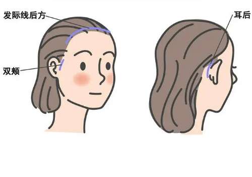 拉皮1.jpg