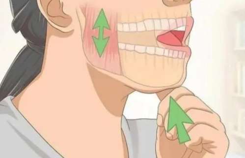 下颌骨不对称动漫.jpg