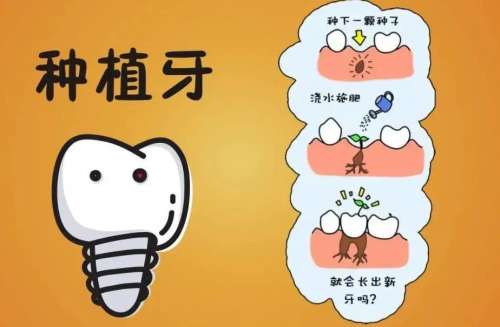 种植牙动漫01.jpg 种植牙动漫01.jpg
