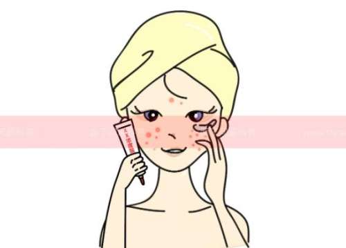 果酸换肤1.jpg