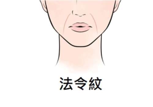 法令纹1.jpg