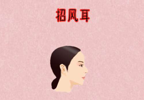 招风耳 (2).jpg