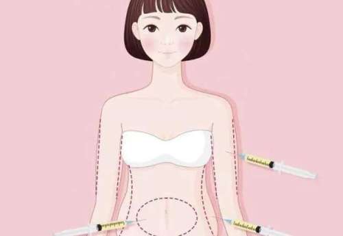 腰腹吸脂 腰腹吸脂