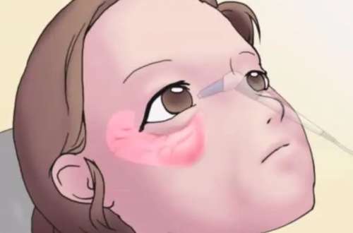 ۴