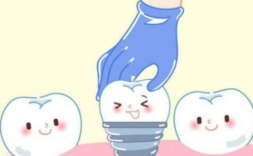 牙齿种植1.jpg