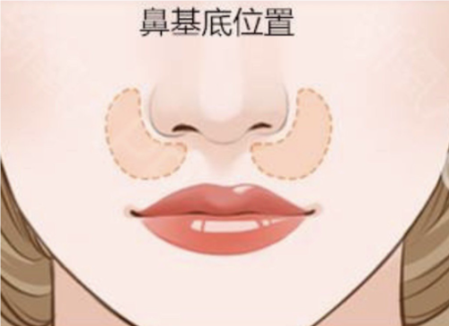 QQ20240807-115948.png