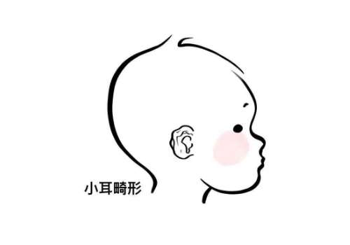 耳再造5.jpg