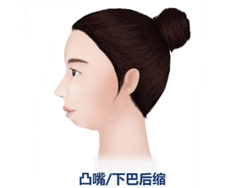 QQ20240809-121525.png