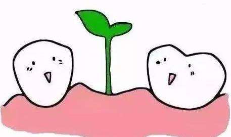 种植牙 种植牙