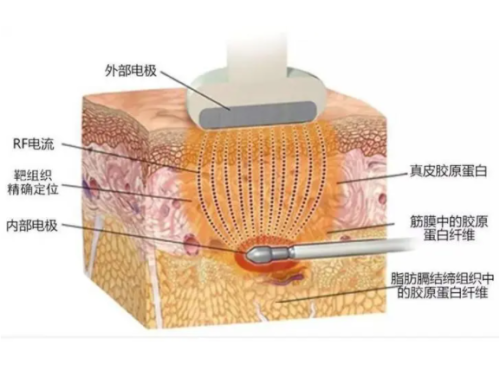 QQ20240814-113852.png