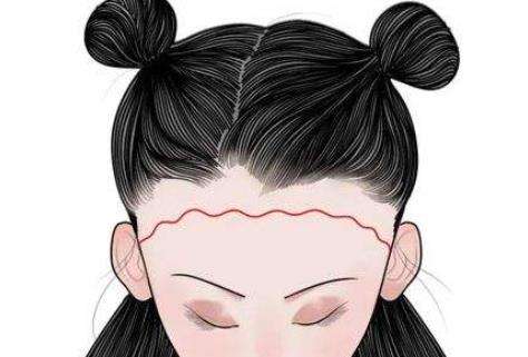 发际线dm25.jpg 发际线dm25.jpg