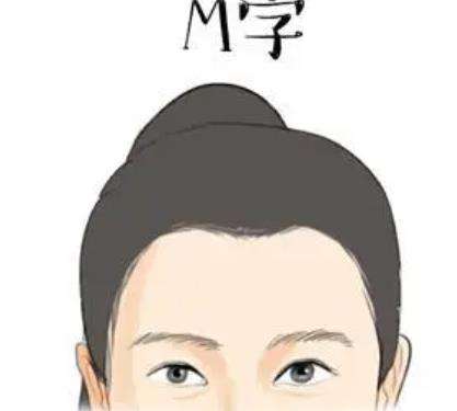 m型发际线05.jpg m型发际线05.jpg
