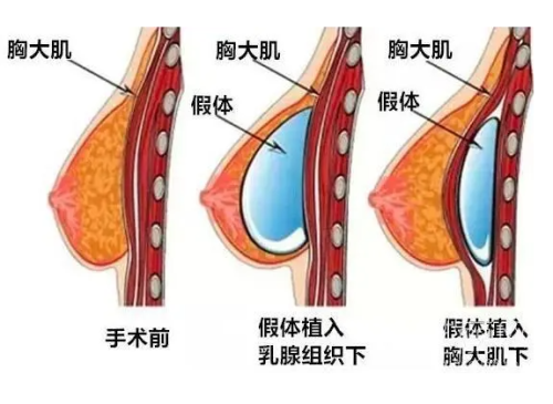 QQ20240829-112748.png
