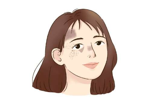 斑1.jpg