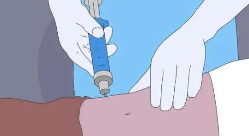 大腿 大腿