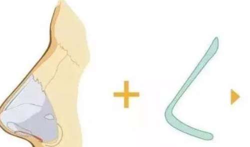 ¡