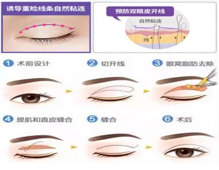 QQ浏览器截图20210908175257.jpg
