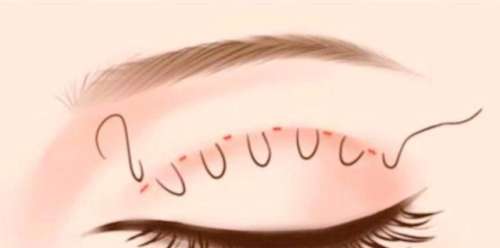 ˫Ƥ