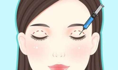 双眼皮手术原理动漫6.jpg