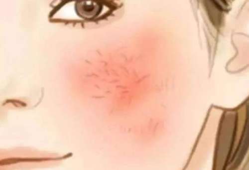 红血丝动漫hg4.jpg